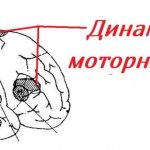 Dynamic aphasia