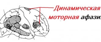 Динамическая афазия