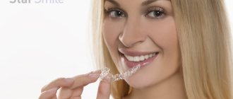 Star Smile aligners are an excellent alternative to treatment with braces